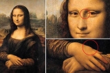 Maleriet af Mona Lisa afslører en gul uregelmæssig læder-lignende plet på det inderste af venstre øverste øjenlåg. En 3 cm lang ujævn hævelse på højre hånd under pegefingeren indikerer FH.