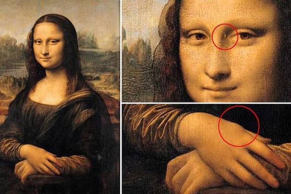 Havde Mona Lisa forhøjet kolesterol?